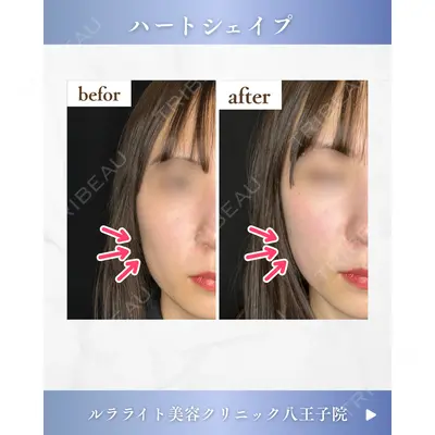 ルラライト美容クリニック 八王子院 桑野 淳医師の症例