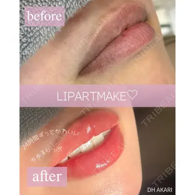 nico wellness デンタルクリニック広尾 あかり医師の症例