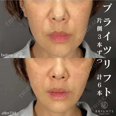 BRIGHTS beauty clinic 今村 直樹医師の症例