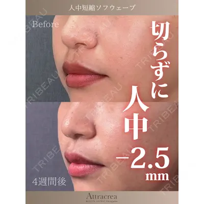 Attracrea BEAUTY CLINIC Shinjuku 佐藤 光医師の症例