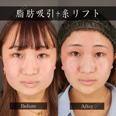 Tokyo Tensei Clinic 新宿院 小瀬 洸春医師の症例