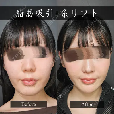 Tokyo Tensei Clinic 新宿院 小瀬 洸春医師の症例