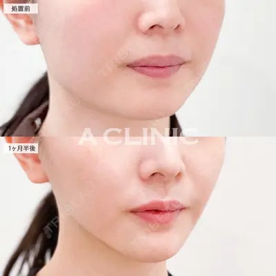 A CLINIC（エークリニック） 大阪院 田窪 賢志郎医師の症例