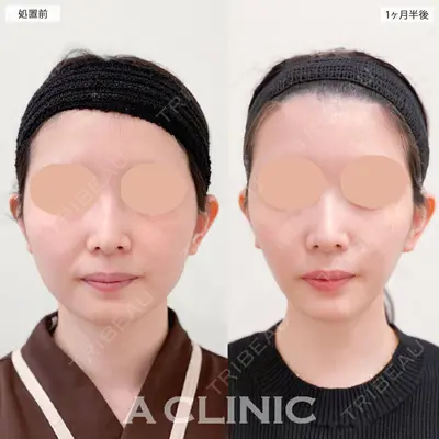 A CLINIC（エークリニック） 大阪院 田窪 賢志郎医師の症例