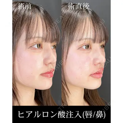 HAAB×DREAM BEAUTY CLINIC 大阪梅田院 柏木 太雅医師の症例