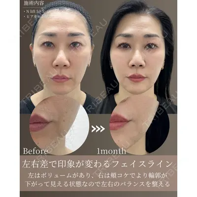 gift clinic 能登谷 翔医師の症例