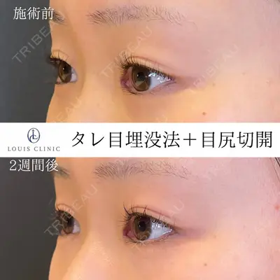 LOUIS CLINIC 二子玉川院【ルイクリニック】 小松 塁医師の症例
