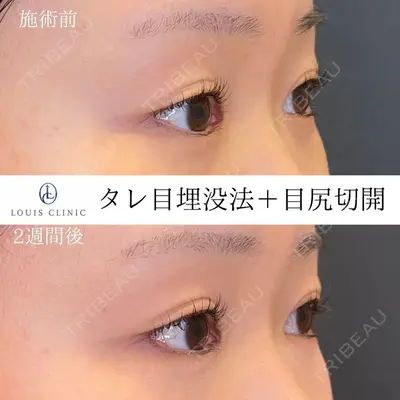LOUIS CLINIC 二子玉川院【ルイクリニック】 小松 塁医師の症例
