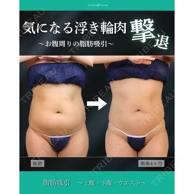 ガーデンクリニック 福岡院 安立 弘太医師の症例