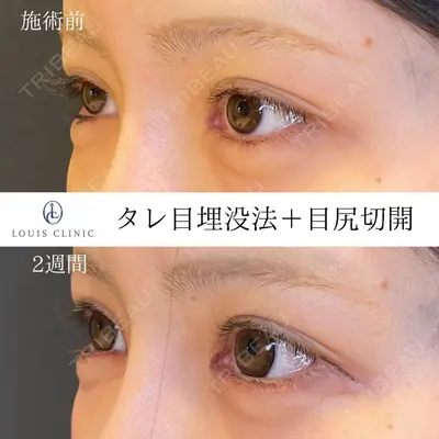 LOUIS CLINIC 二子玉川院【ルイクリニック】 小松 塁医師の症例
