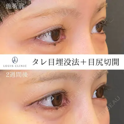 LOUIS CLINIC 二子玉川院【ルイクリニック】 小松 塁医師の症例