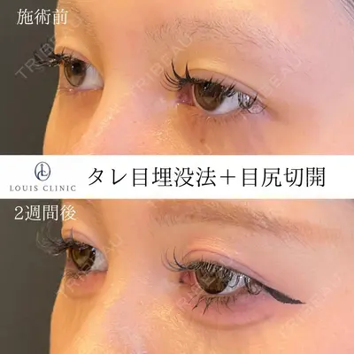 LOUIS CLINIC 二子玉川院【ルイクリニック】 小松 塁医師の症例