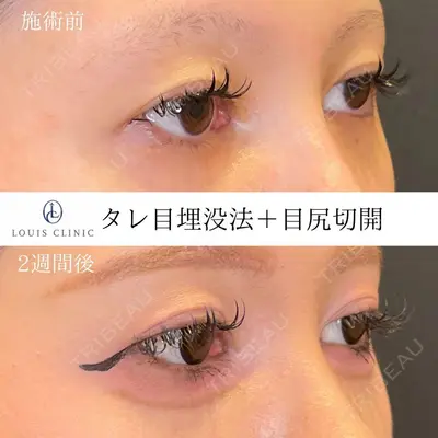LOUIS CLINIC 二子玉川院【ルイクリニック】 小松 塁医師の症例