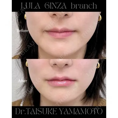 ルラ美容クリニック銀座院 山本 泰輔医師の症例