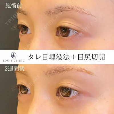 LOUIS CLINIC 二子玉川院【ルイクリニック】 小松 塁医師の症例