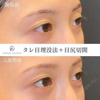 LOUIS CLINIC 二子玉川院【ルイクリニック】 小松 塁医師の症例