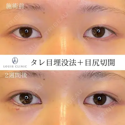 LOUIS CLINIC 二子玉川院【ルイクリニック】 小松 塁医師の症例