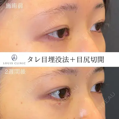 LOUIS CLINIC 二子玉川院【ルイクリニック】 小松 塁医師の症例