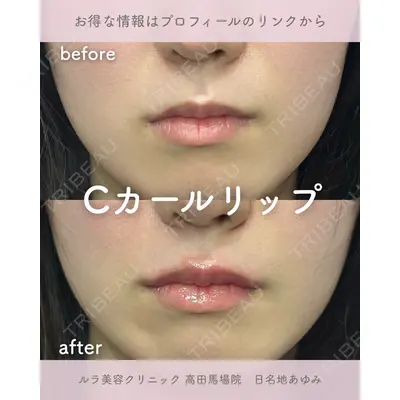 ルラ美容クリニック 高田馬場院 日名地 あゆみ医師の症例