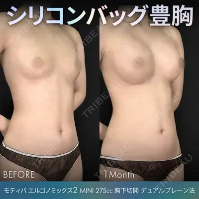 ジョウクリニック 銀座院の症例