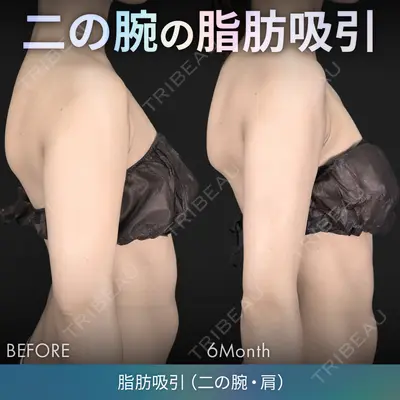 ジョウクリニック 銀座院 重本　譲医師の症例