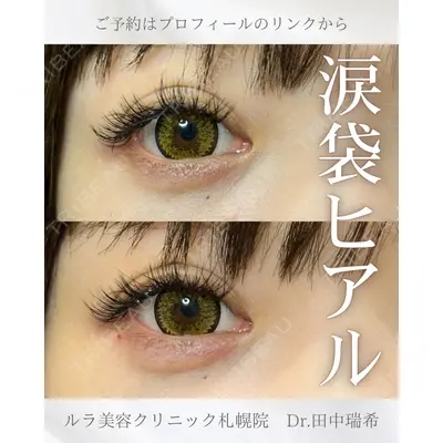 ルラ美容クリニック 札幌本院 田中 瑞希医師の症例