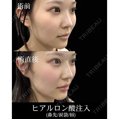 HAAB×DREAM BEAUTY CLINIC 東京本院 佐野 圭医師の症例