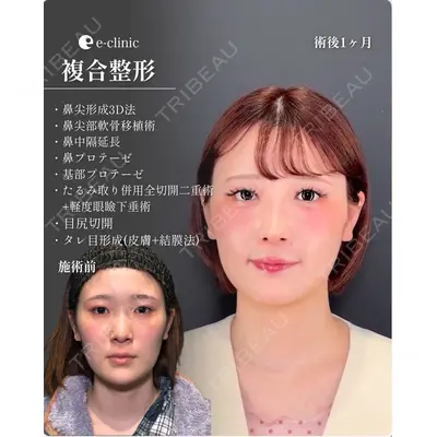 eクリニック 福岡院 伊藤 渉医師の症例
