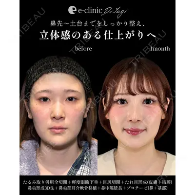 eクリニック 福岡院 伊藤 渉医師の症例