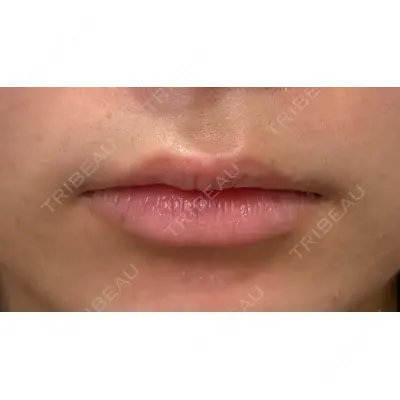 Ledian Clinic六本木の症例