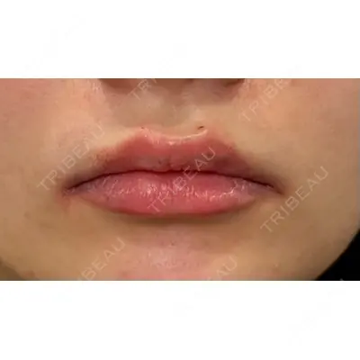 Ledian Clinic六本木の症例