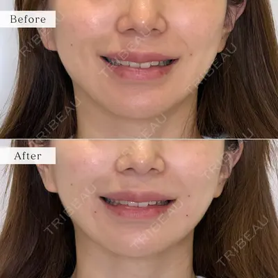 nico wellness デンタルクリニック広尾 佐藤 大晟医師の症例