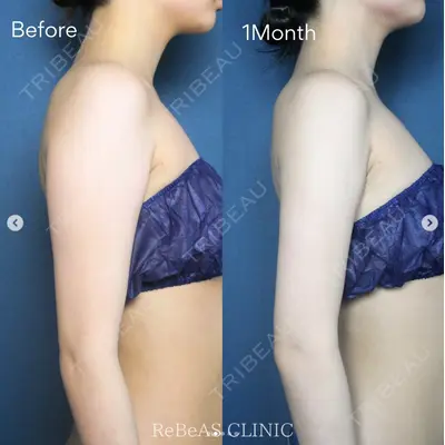 ReBeAS CLINICの症例