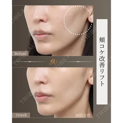 gift clinic 能登谷 翔医師の症例