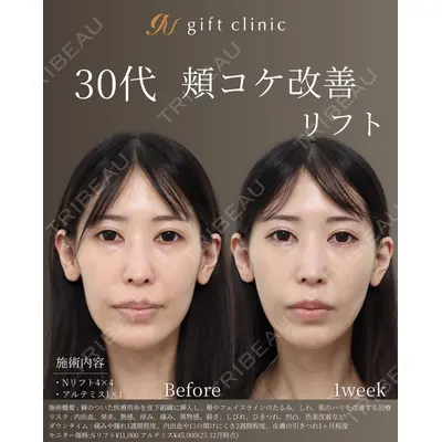 gift clinic 能登谷 翔医師の症例