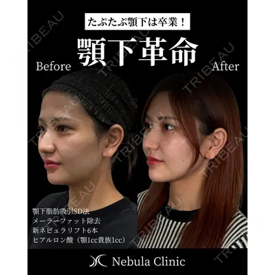 愛知春日井美容外科ネビュラクリニック 都築 諒医師の症例