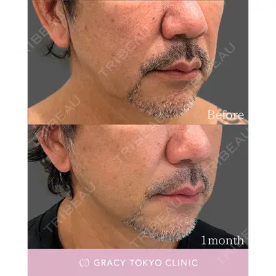 GRACY TOKYO CLINIC【グレイシートウキョウクリニック】 大西 真代医師の症例