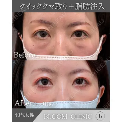 ブルームクリニック（BLOOM CLINIC） 大西 雅樹医師の症例