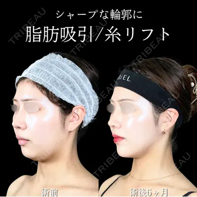 アリエル美容クリニック 大宮院 鈴木　桂介医師の症例