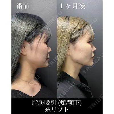 HAAB CLINIC 池袋院 野田 裕太郎　医師の症例
