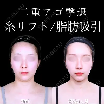 アリエル美容クリニック 水戸院 天白 典秀医師の症例