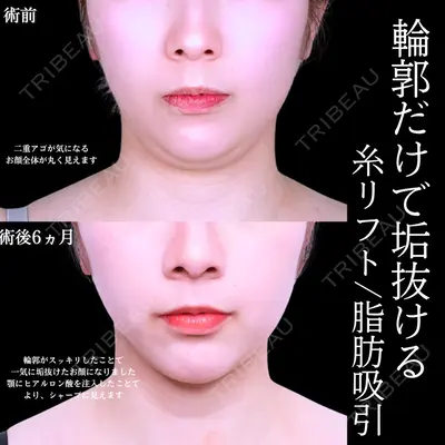 アリエル美容クリニック 水戸院 天白 典秀医師の症例