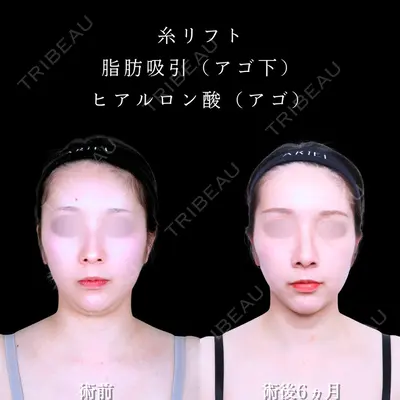 アリエル美容クリニック 水戸院 天白 典秀医師の症例