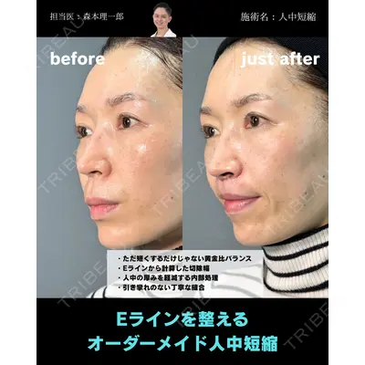 PRISM Beauty Clinic 町田院の症例