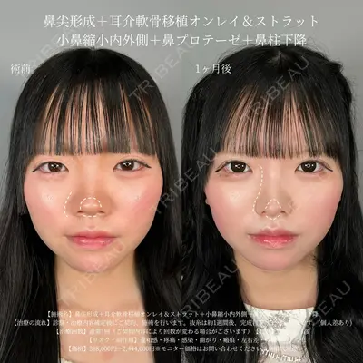 ASTRA BEAUTY CLINIC 塩満 惠子医師の症例