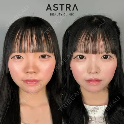 ASTRA BEAUTY CLINIC 塩満 惠子医師の症例