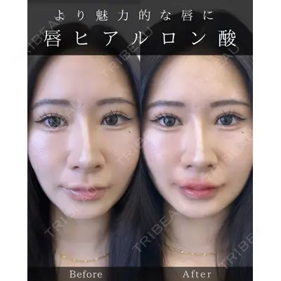 ルラ美容クリニック 大宮院 / ルラスキンクリニック 大宮院 右京 大季医師の症例