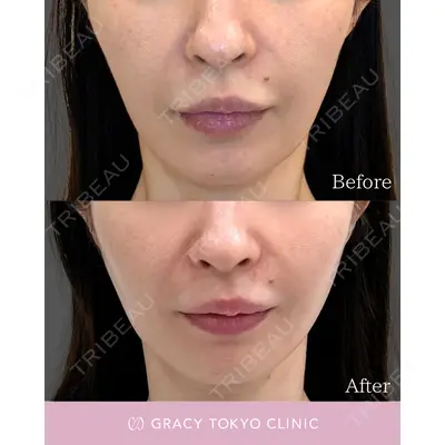 GRACY TOKYO CLINIC【グレイシートウキョウクリニック】 大西 真代医師の症例
