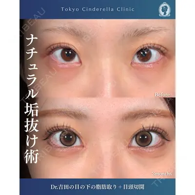 東京シンデレラ美容外科  横浜院 吉田 利之医師の症例