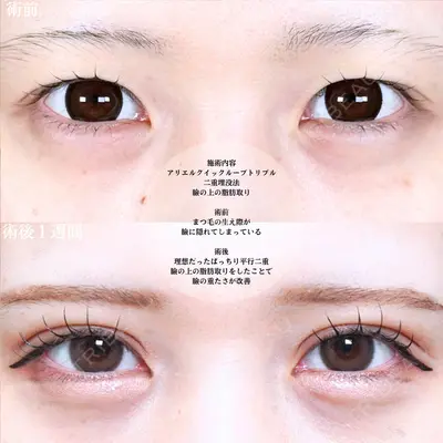 アリエル美容クリニック 大宮院 鈴木　桂介医師の症例